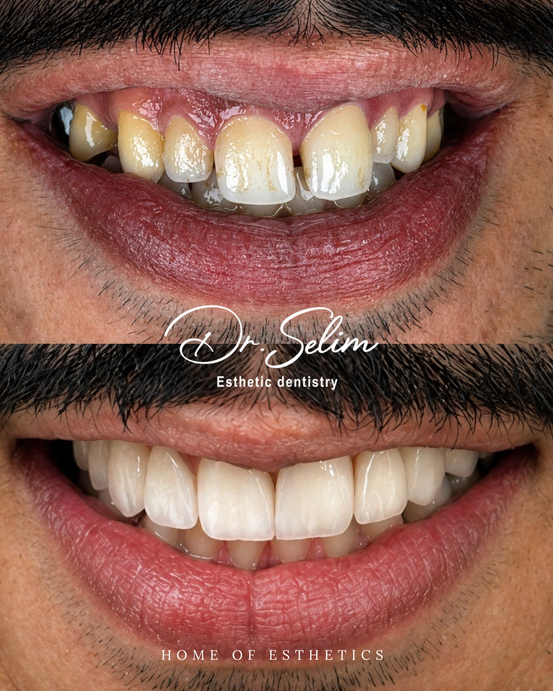 Case 2 - Before & After